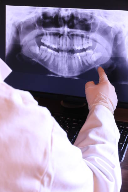 Best Emergency Dental Extractions in Sands Point, NY